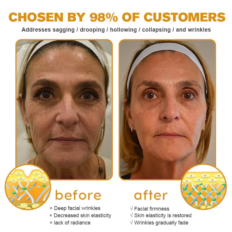 Botox Bee Venom Wrinkle Removal Cream- LAST DAY 80% OFF
