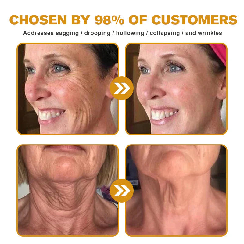 Botox Bee Venom Wrinkle Removal Cream- LAST DAY 80% OFF