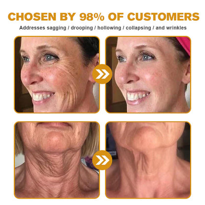 Botox Bee Venom Wrinkle Removal Cream- LAST DAY 80% OFF