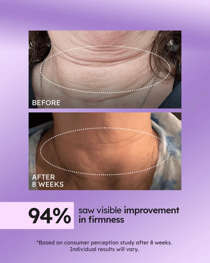 Advanced Tightening Neck Cream