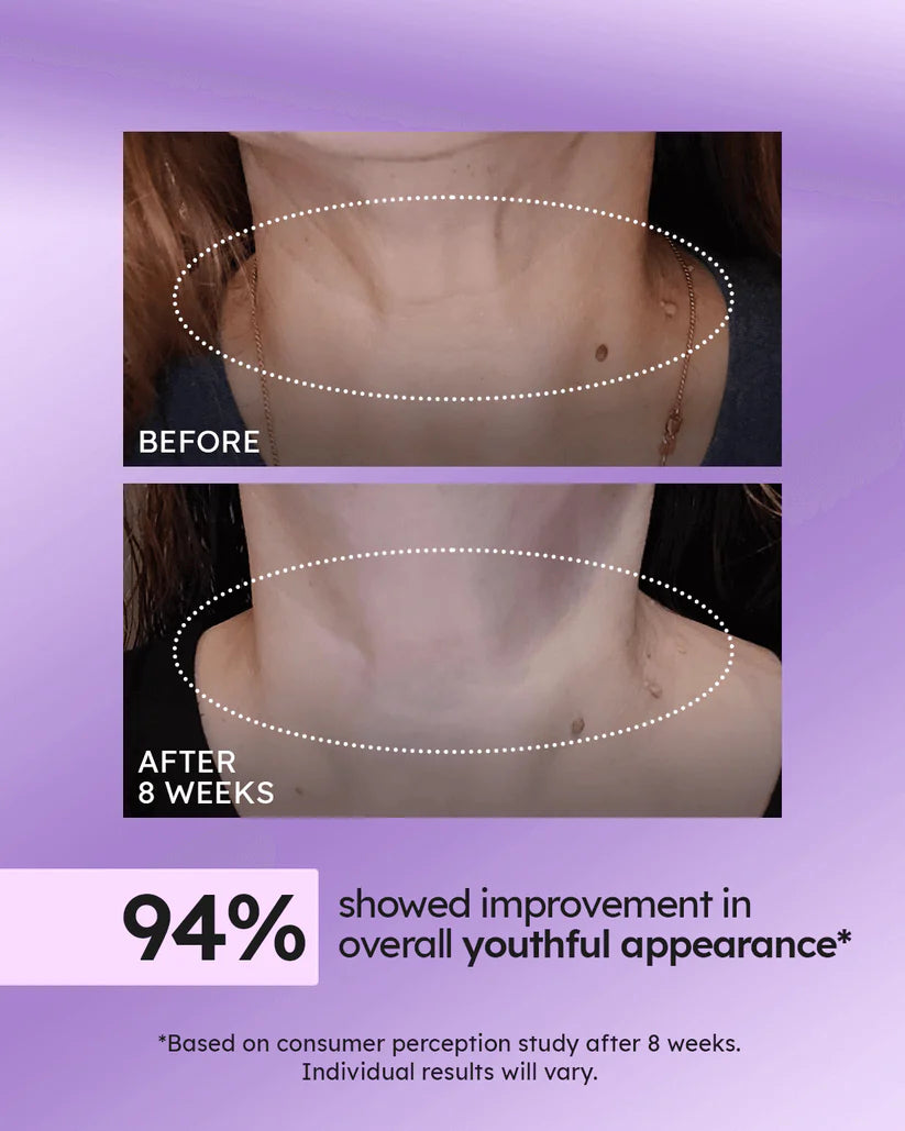 Advanced Tightening Neck Cream