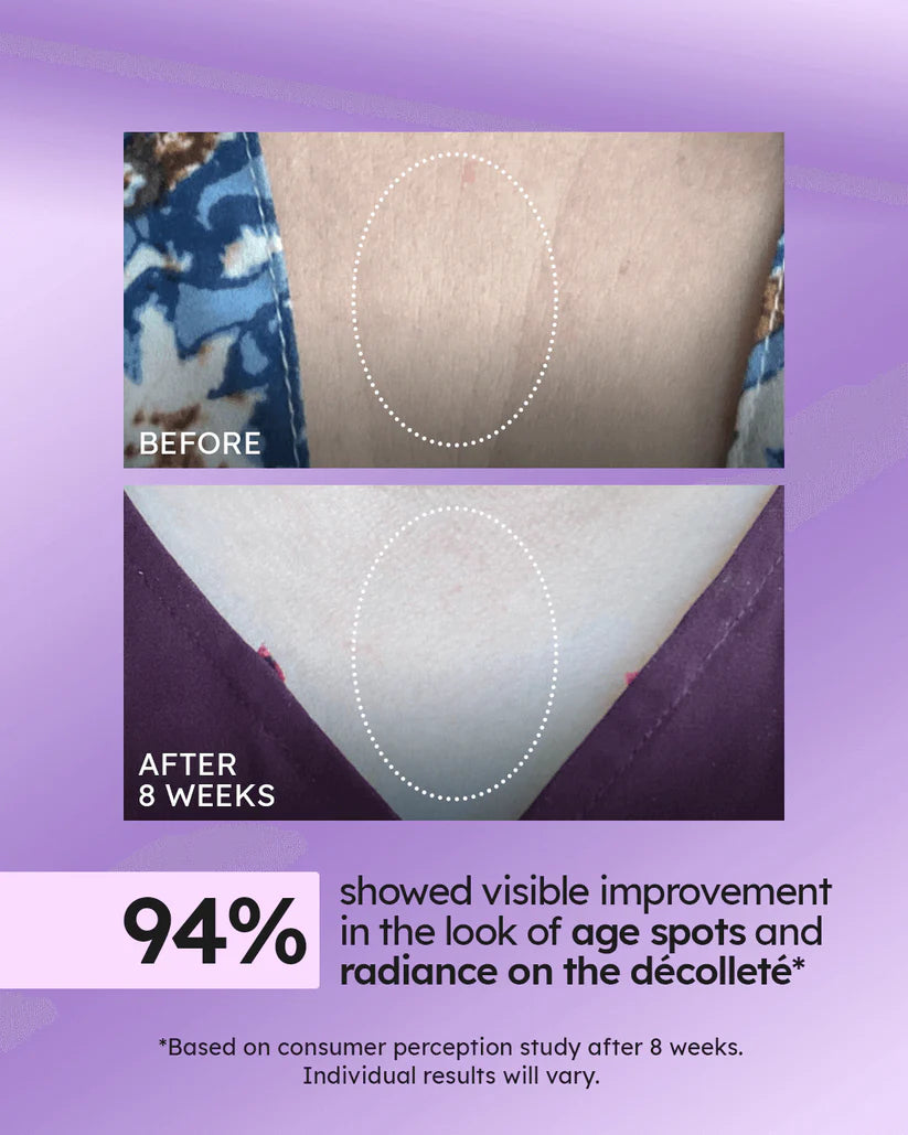 Advanced Tightening Neck Cream